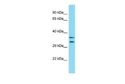 LMOD3 Rabbit anti-Human, Polyclonal, Novus Biologicals 0.1 mL | Buy Online | Novus Biologicals | Fisher Scientific